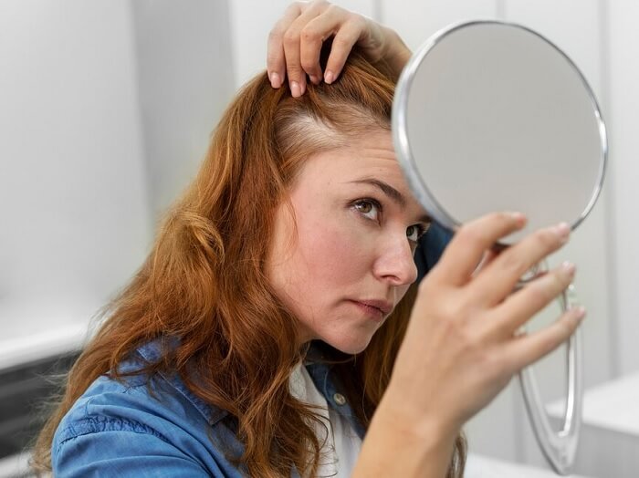 a woman suffering from baldness