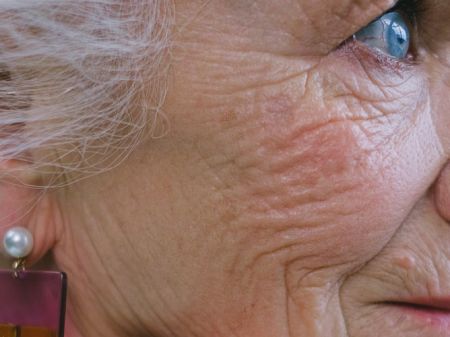 6 Wrinkle Prevention Tips You Need To Know