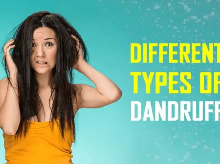 6 Different Kinds of Dandruff and How to Get Rid of Them